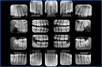 P.A. de Mandíbula - Unimagem Radiografia Odontológica Curitiba